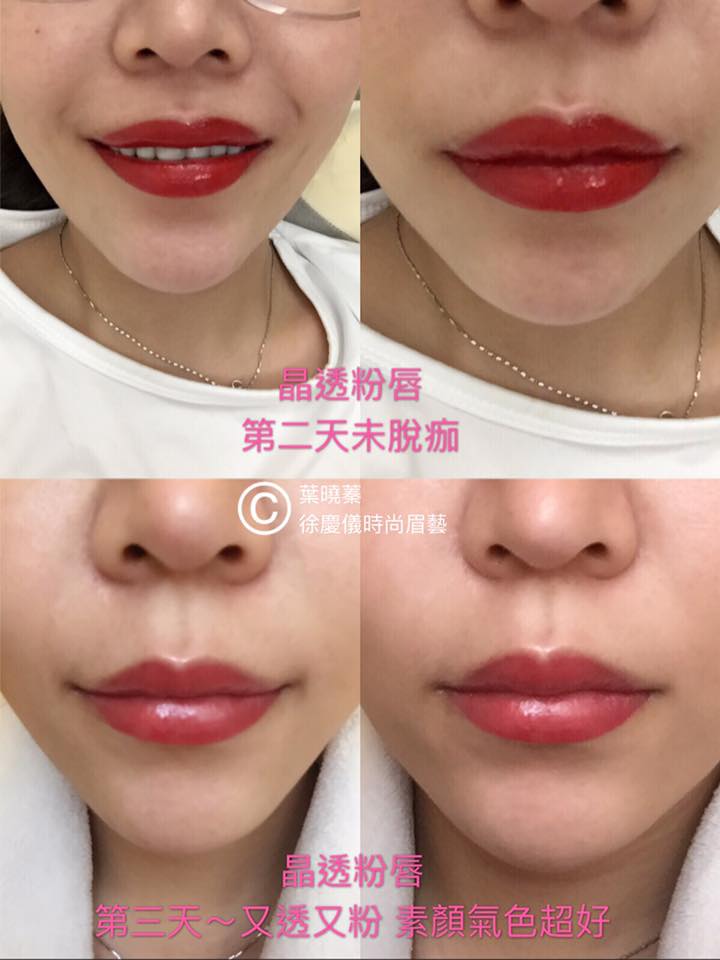 【晶透粉唇/嘟嘟唇/裸唇/微笑唇】