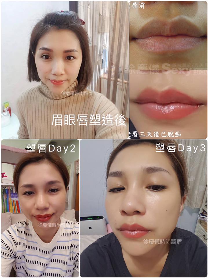 【晶透粉唇/嘟嘟唇/裸唇/微笑唇】