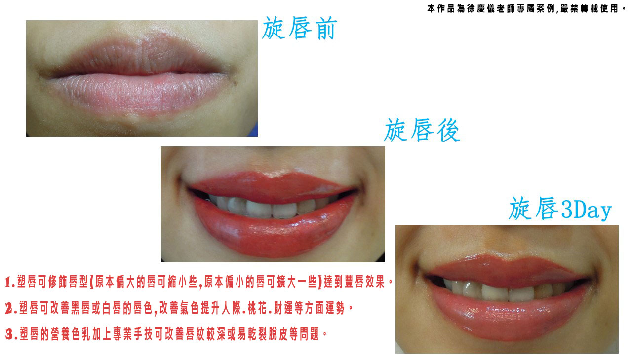 【晶透粉唇/嘟嘟唇/裸唇/微笑唇】