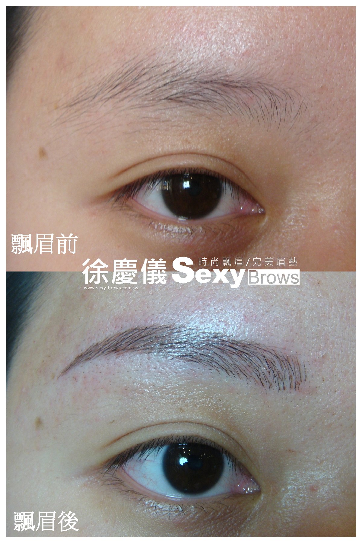 柔細眉案例